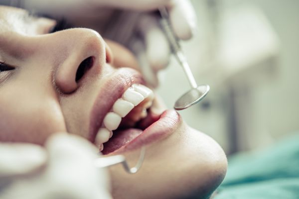 a woman with her mouth open and the dentist is holding  a mirror and dental tool to her mouth depicting a dental checkup