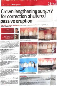 Crown Lengthening Surgery clip from The Dentistry featuring Dr. Ioannis Papadopoulos