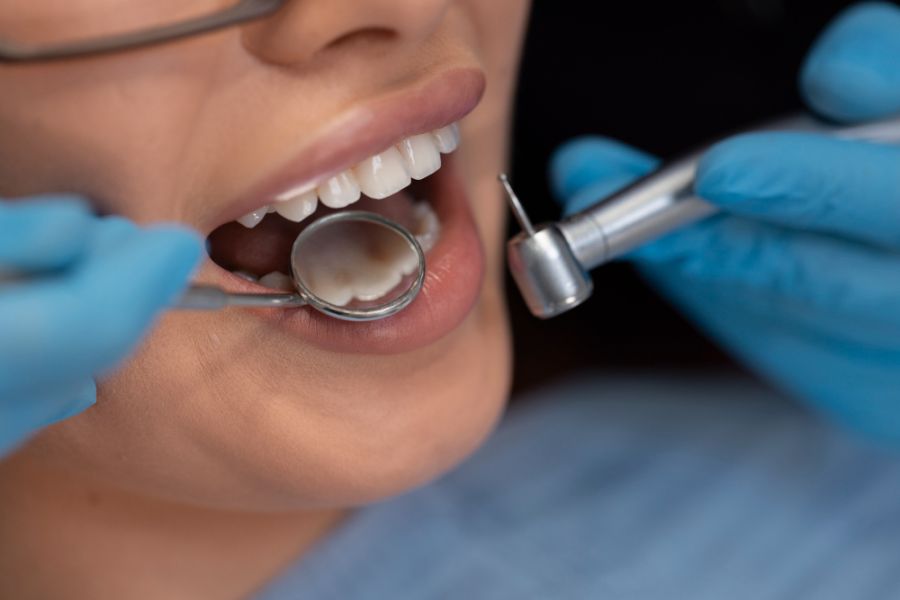 woman's mouth  opened with dental drill and mirror